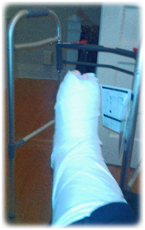 foot in a cast